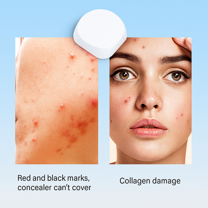 DermaDot™ - LED Light Therapy Pimple Patch