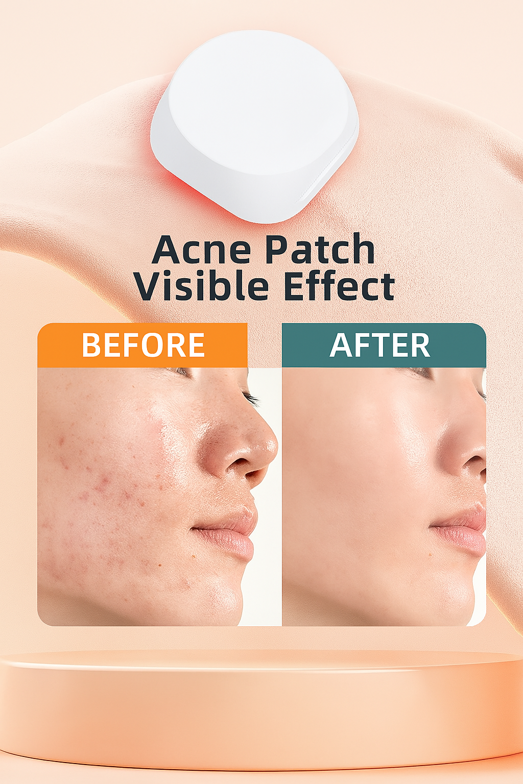 DermaDot™ - LED Light Therapy Pimple Patch